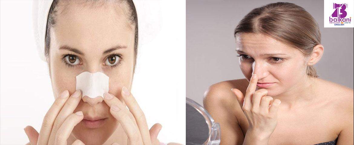 Keep your skin clear and pimple free with these home cures